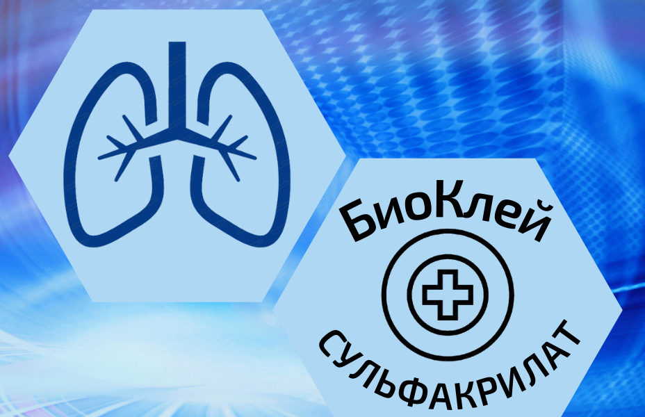 Торакальная хирургия